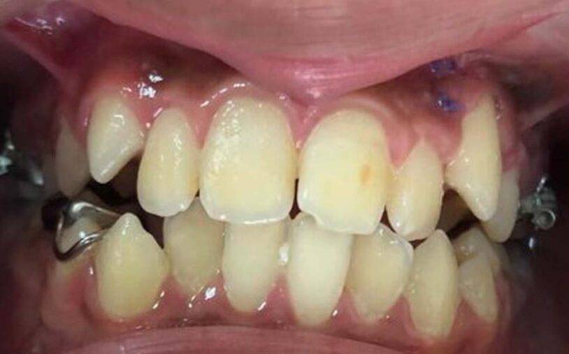 Before - Priory House Dental