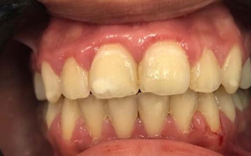 After - Priory House Dental