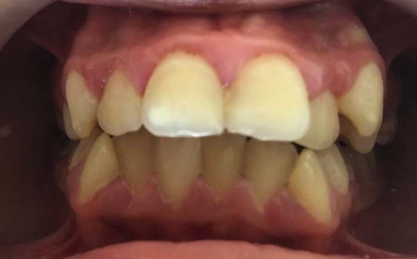 Before - Priory House Dental