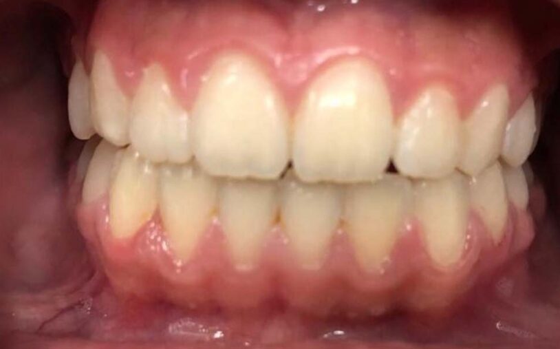 After - Priory House Dental