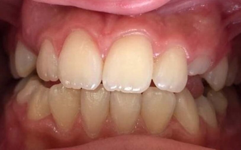 Before - Priory House Dental